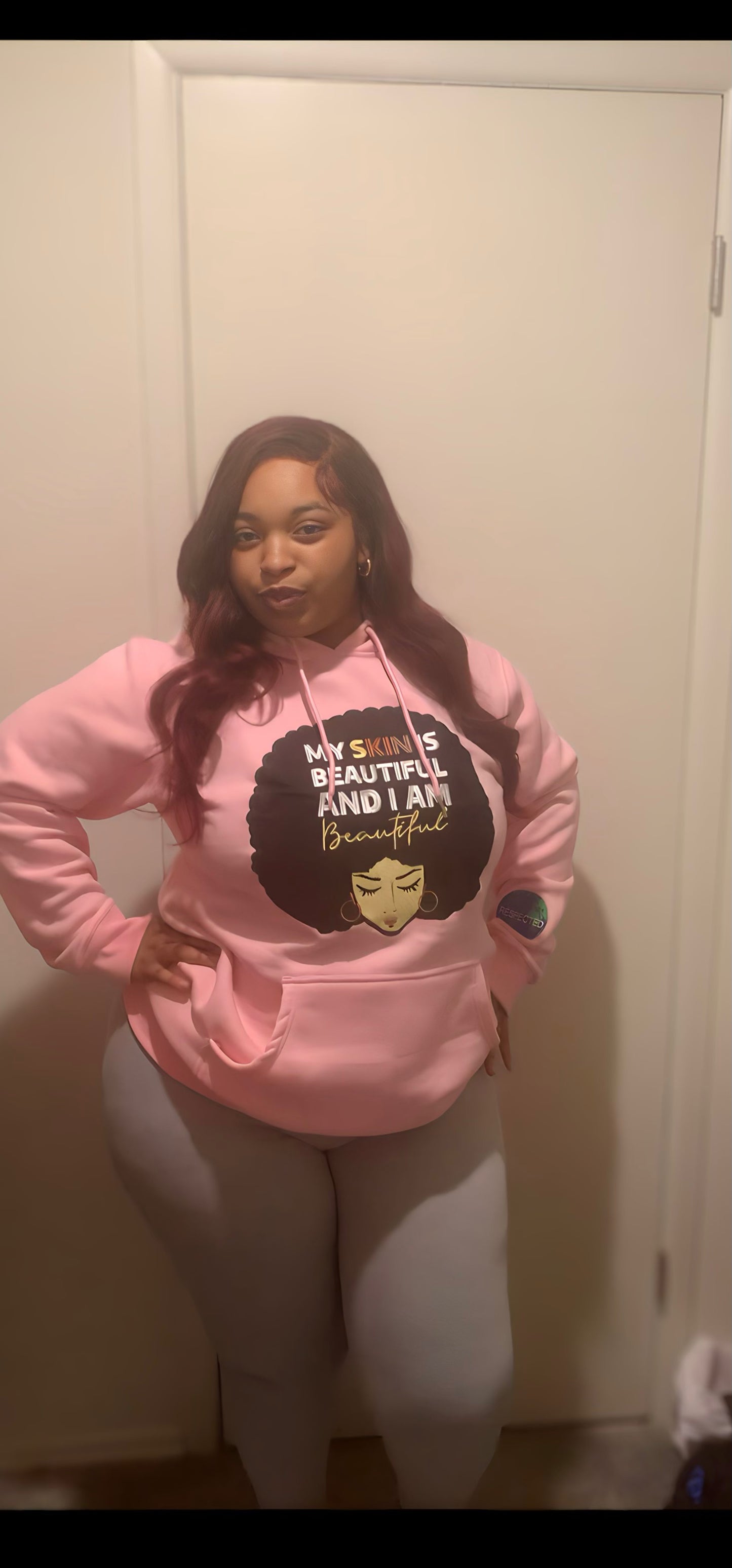 Beautiful Skin Tshirt or Hoodie (Pink)